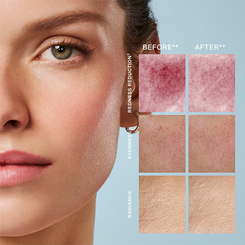 Kết quả trước và sau khi dùng Swiss Pristine Serum